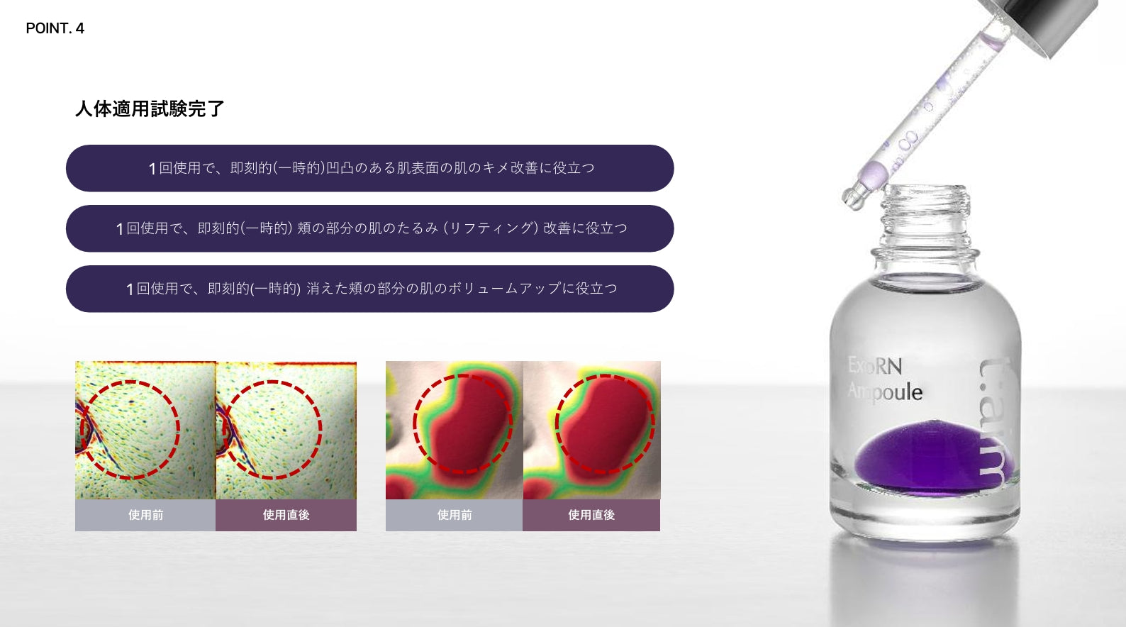 t:aim ExoRN （ﾃｨｴｲﾑｴｸｿｱｰﾙｴﾇ）美容液 30ml クリニックプロダクト