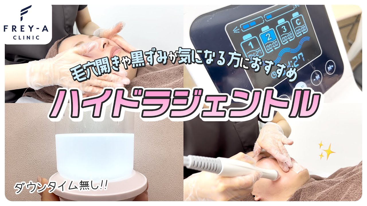 毛穴開きや黒ずみにはこれ！】ハイドラジェントルをご紹介 - YouTube