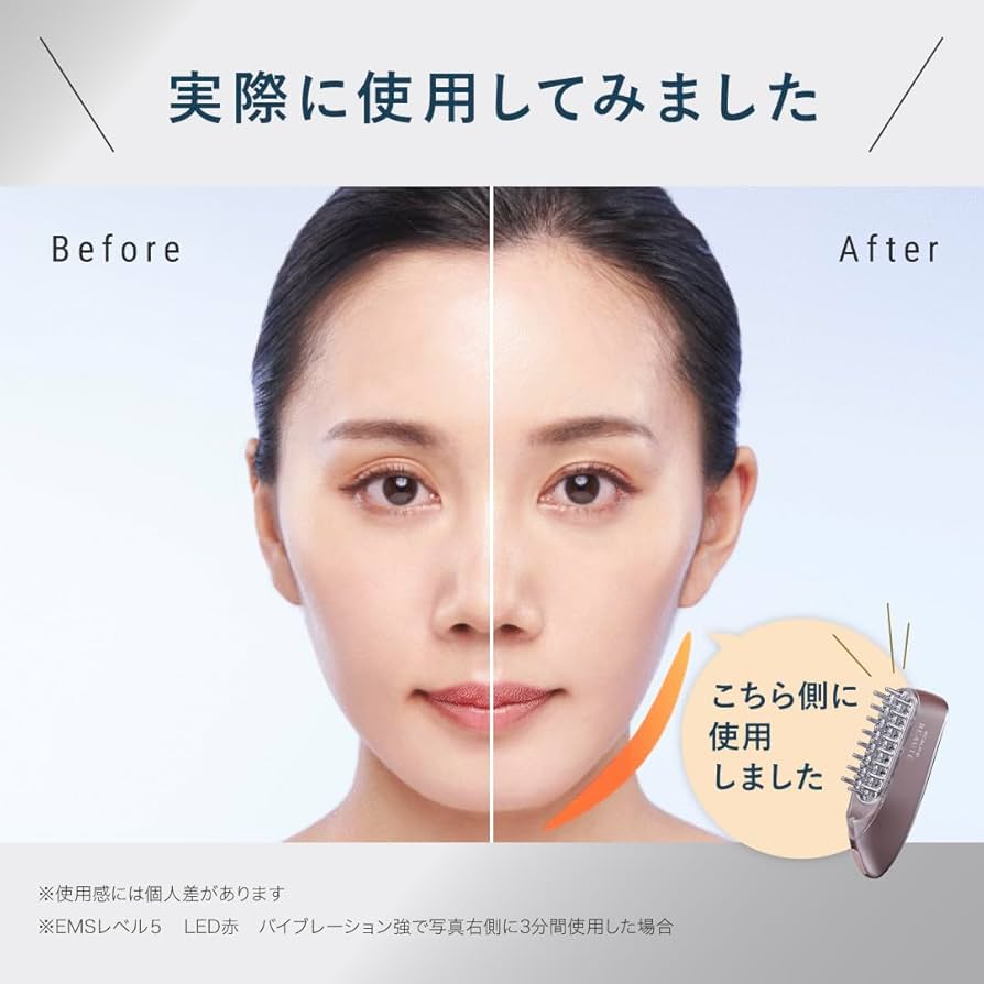 Amazon.co.jp: スカルプD ボーテ スカルプ電気ブラシ 医師監修
