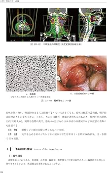 新耳鼻咽喉科学 | 野村 恭也, 加我 君孝, 切替 一郎 |本 | 通販 | Amazon
