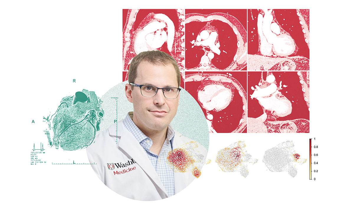 Rewriting the Future of Heart Failure - Outlook Magazine