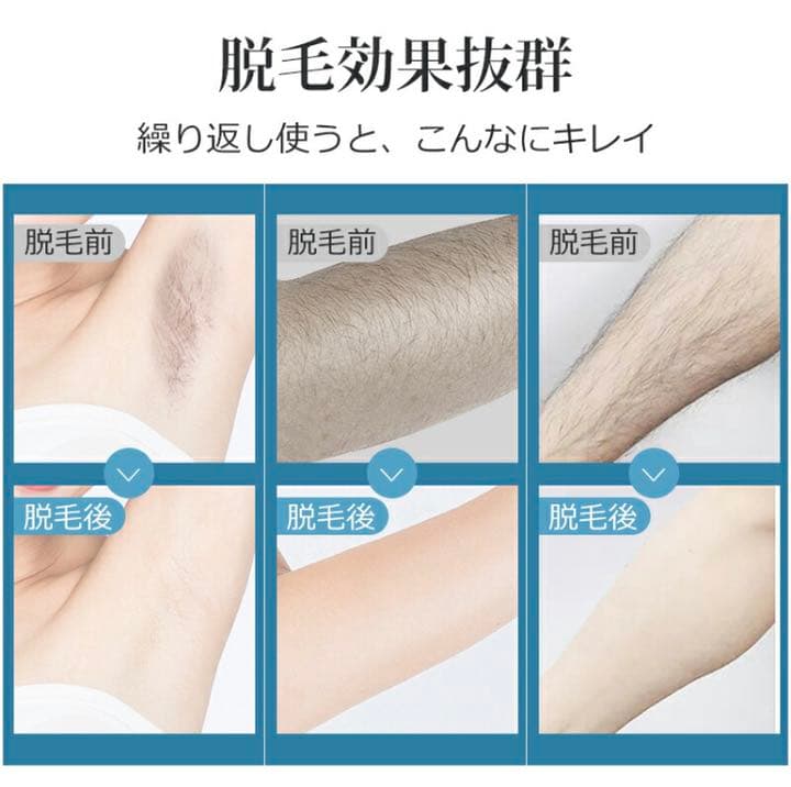 脱毛器